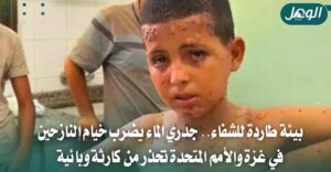الأمم المتحدة تحذر من تفشي جدري الماء في غزة بعد تسجيل 9300 إصابة خلال أسبوعين