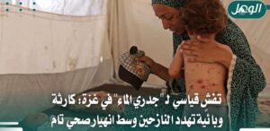 تفشي جدري الماء في غزة.. 53 ألف إصابة وتحذيرات من كارثة صحية