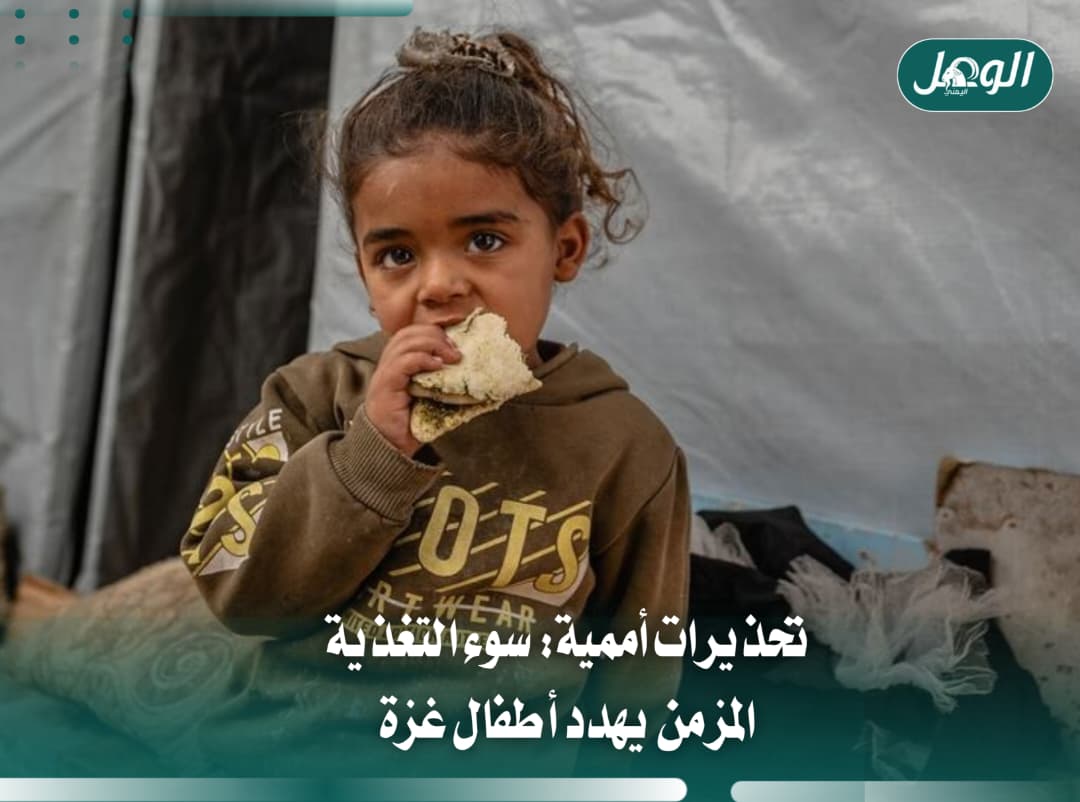 سوء التغذية المزمن يهدد أطفال غزة وسط الحرب
