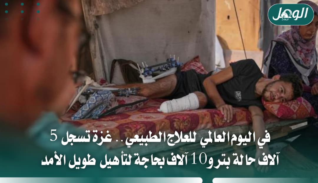 الصحة بغزة: 5 آلاف حالة بتر و10 آلاف بحاجة للتأهيل