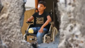 3 أعوام من إبادة غزة.. 10 آلاف طفل فقدوا ساقًا على الأقل